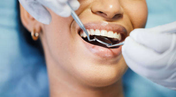 Best Emergency Tooth Extraction  in Sonoma, CA