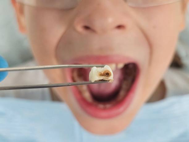 Best Broken Tooth Emergency  in Sonoma, CA